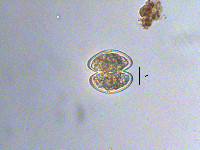 Staurastrum lapponicum image
