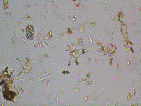 Image of Staurastrum dejectum