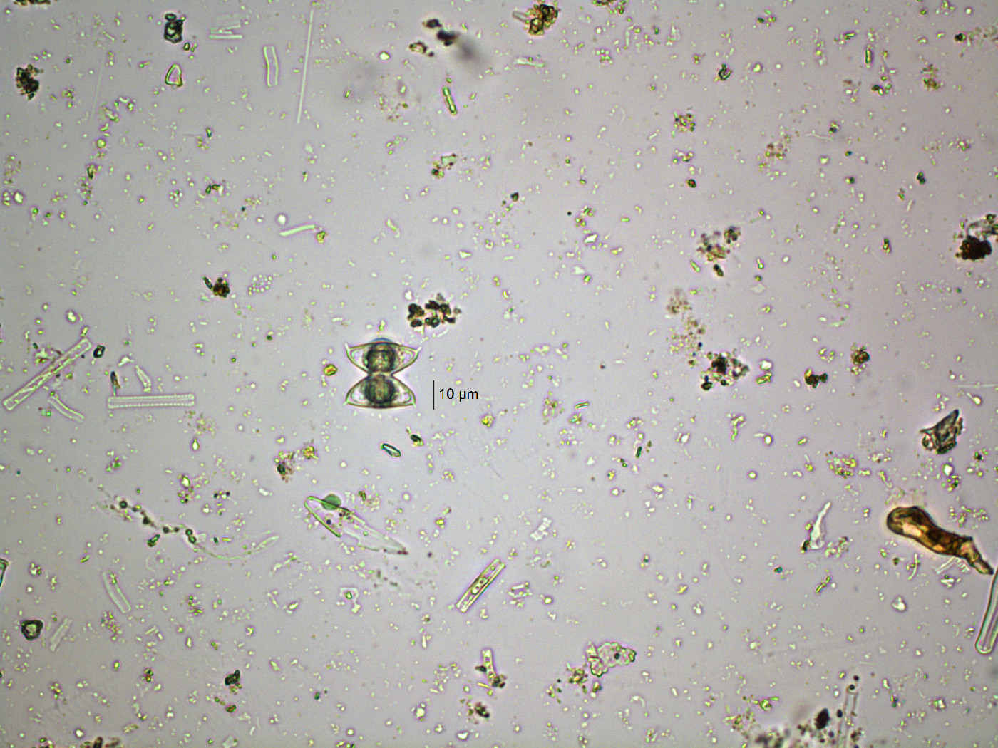 Staurastrum dejectum var. patens image
