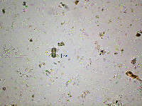 Staurastrum dejectum image