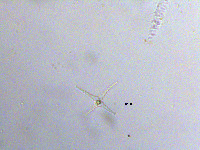 Staurastrum excavatum image
