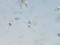 Staurastrum extensum image