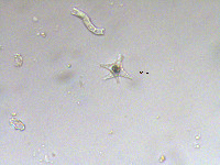 Staurastrum hexacerum image