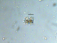 Staurastrum hystrix image