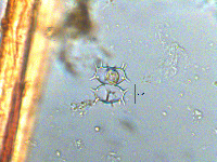 Staurastrum hystrix image