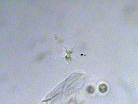 Staurastrum inconspicuum image