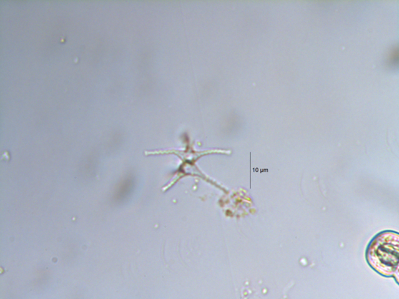 Staurastrum iotanum image