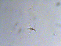 Staurastrum iotanum image