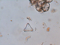 Staurastrum lanceolatum image