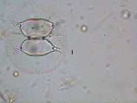 Staurastrum longispinum image