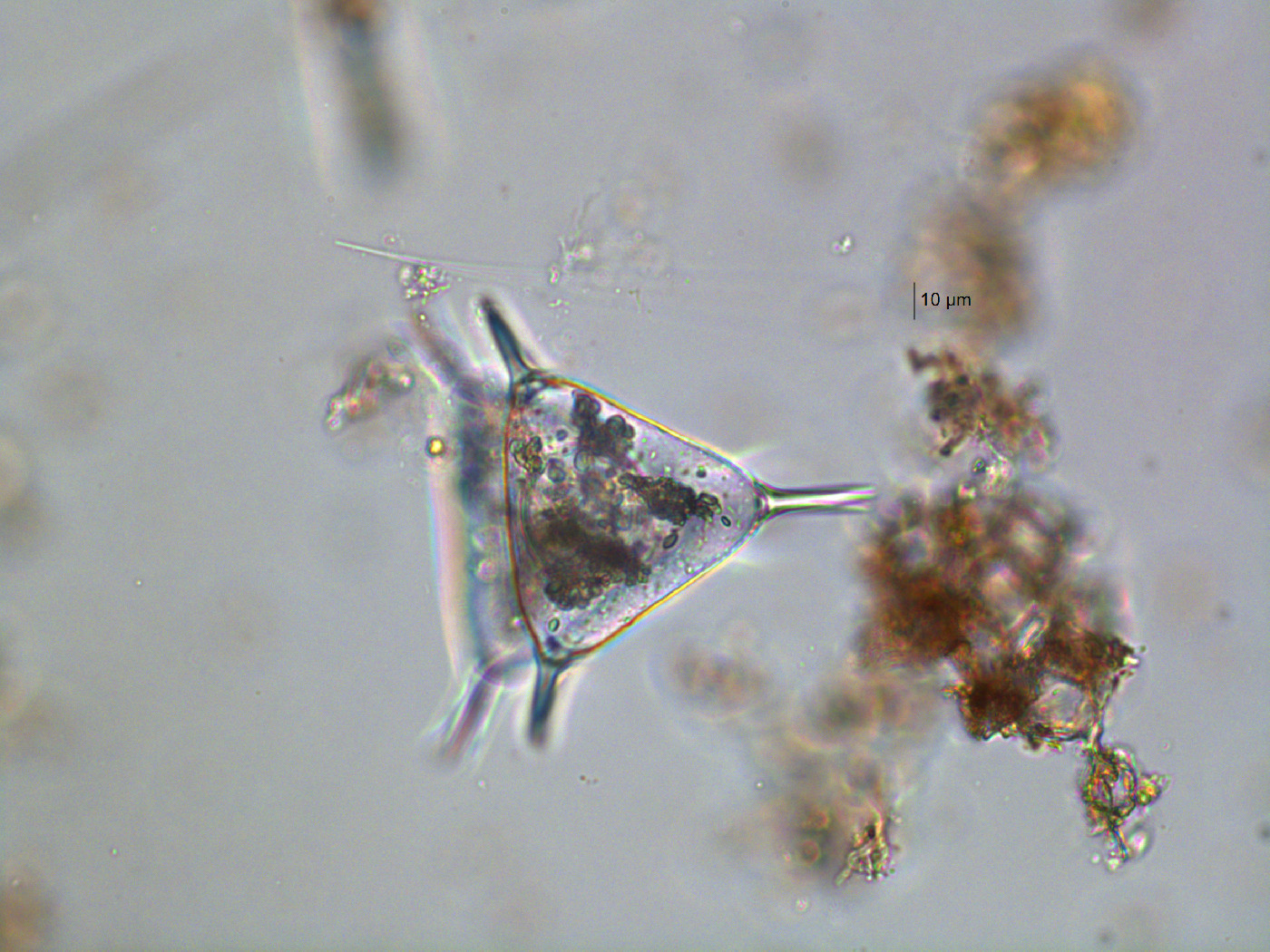 Staurastrum longispinum image