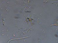 Staurastrum margaritaceum image