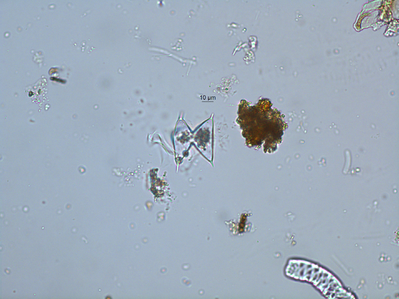 Staurastrum megacanthum image