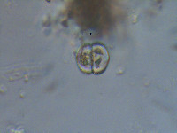 Staurastrum orbiculare image
