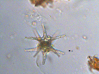 Staurastrum pentacerum image