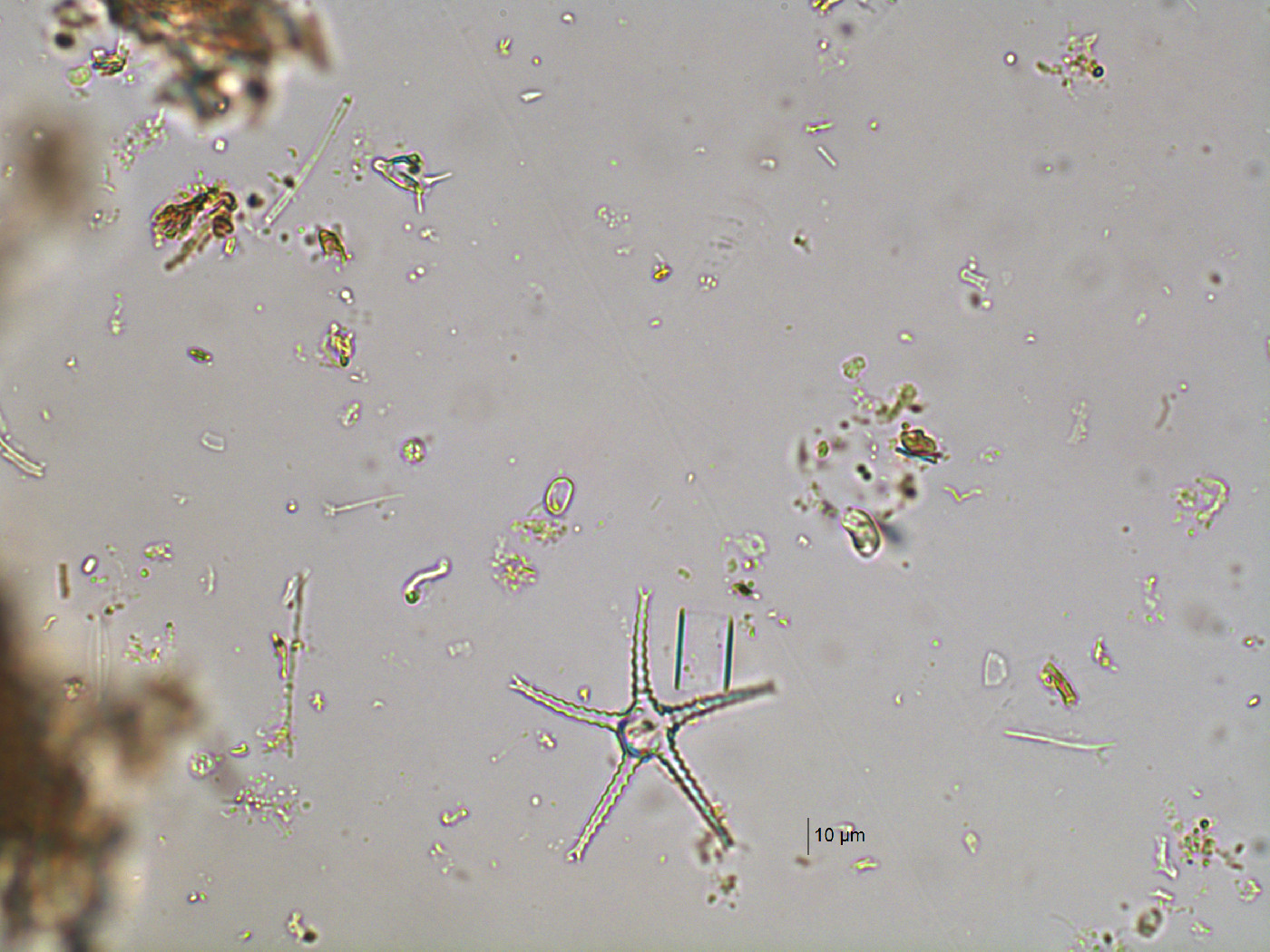 Staurastrum pentacerum image