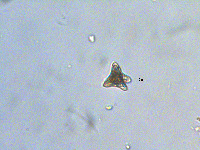 Staurastrum pseudobacillare image