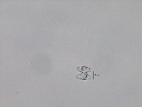 Staurastrum pseudobacillare image