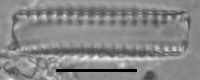 Staurosirella leptostauron var. dubia image