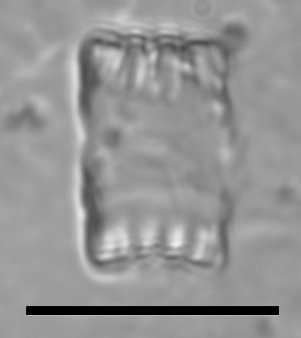 Staurosirella leptostauron var. dubia image