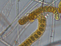 Image of Stigonema ocellatum