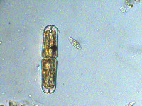 Tetmemorus brebissonii image