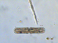 Image of Tetmemorus brebissonii