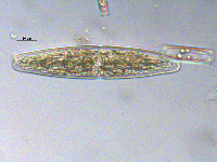 Tetmemorus brebissonii image