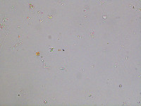 Xanthidium tenuissimum image
