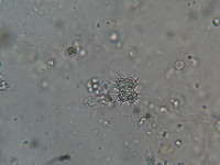 Image of Xanthidium tenuissimum
