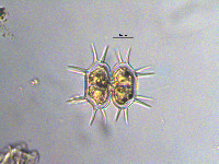 Image of Xanthidium antilopaeum