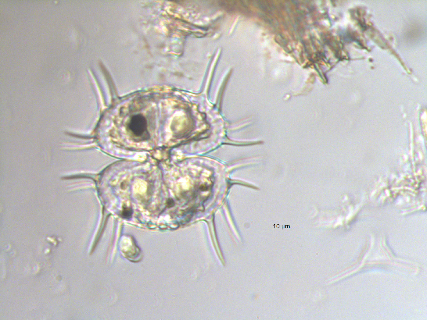 Xanthidium antilopaeum var. polymazum image