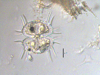 Xanthidium antilopaeum image
