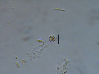 Image of Xanthidium apiculiferum