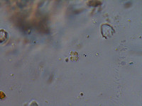 Xanthidium apiculiferum image