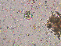 Image of Actinotaenium wollei