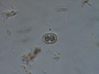 Image of Actinotaenium cruciferum