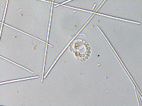 Anabaena circinalis image