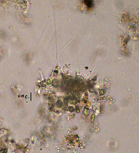 Image of Chaetosphaeridium globosum