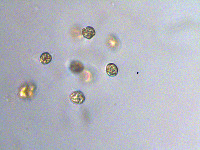 Image of Chroococcus distans