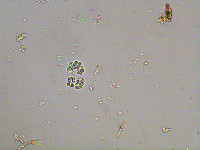 Chroococcus limneticus image