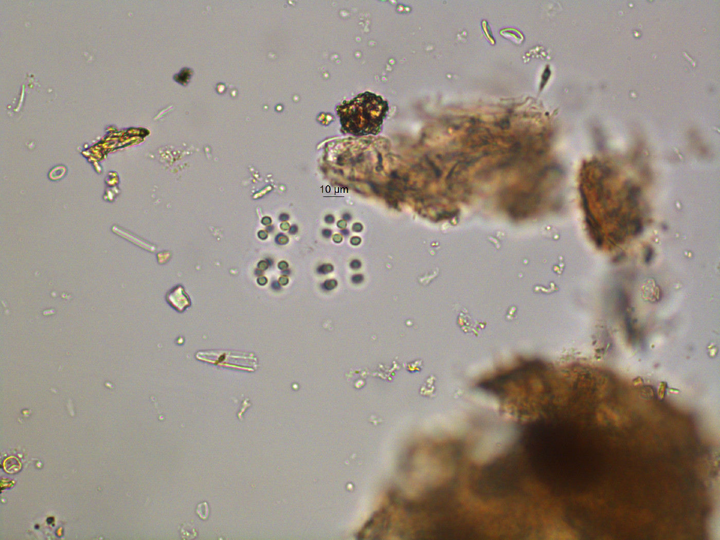 Chroococcus limneticus image