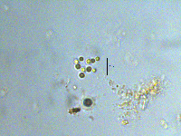 Image of Chroococcus minor