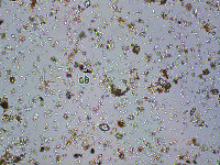 Image of Chroococcus turgidus