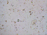 Chroococcus turgidus image