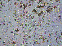 Chroococcus turgidus image