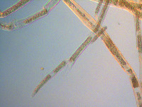 Cladophora glomerata image