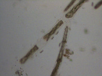 Cladophora glomerata image