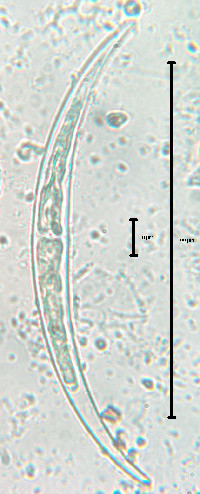 Closterium calosporum image