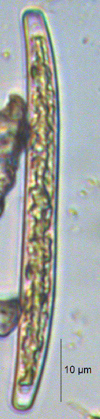 Closterium cornu image